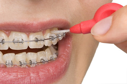 Close-Up of Braces Care with Interdental Brush